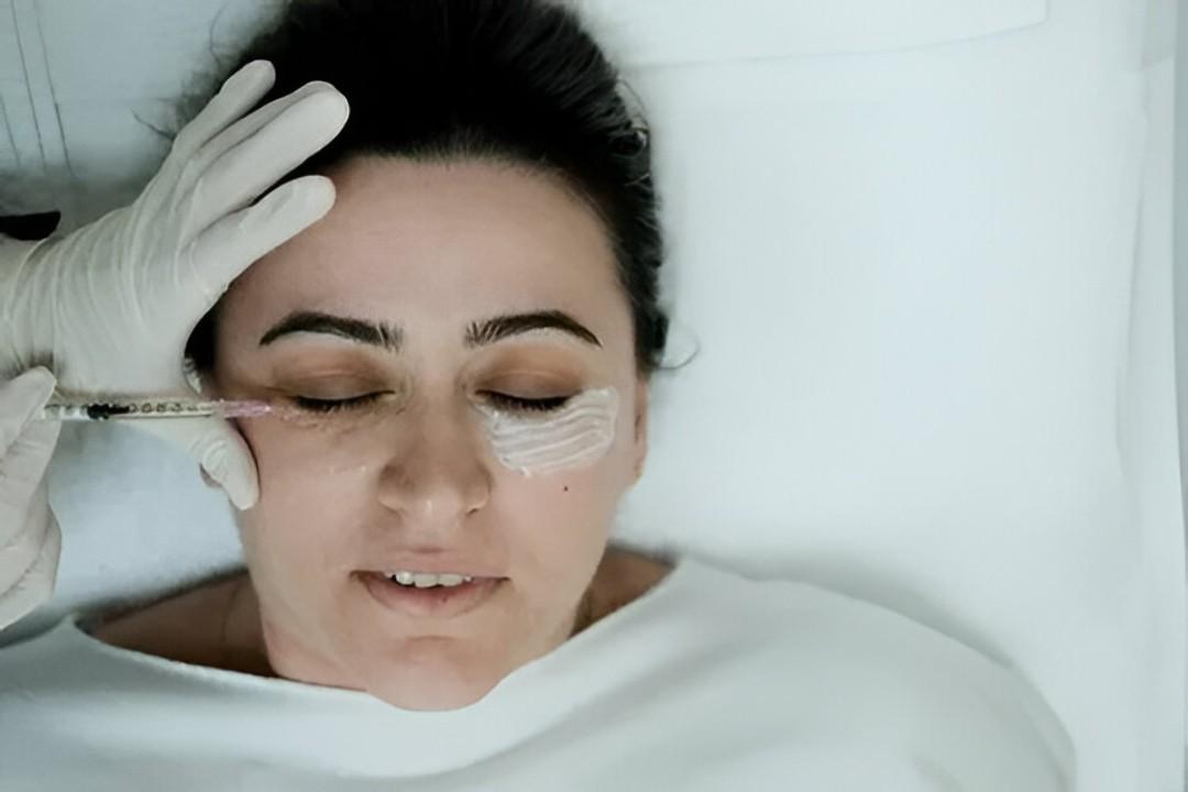 Under Eye Filler Islamabad for Fresh Eyes