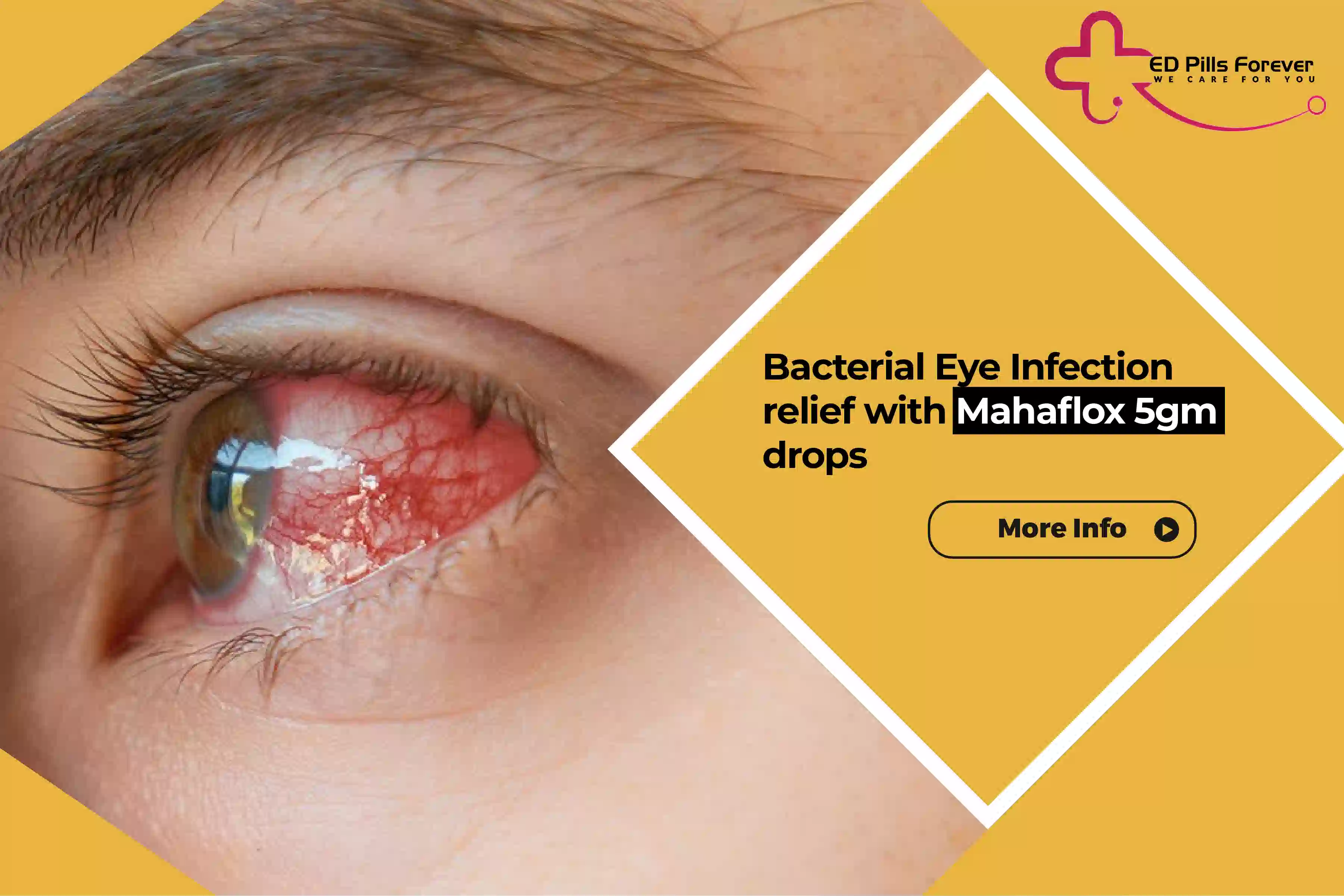 Bacterial Eye Infection Relief with Mahaflox 5 gm Drops